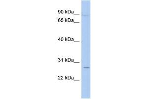 WB Suggested Anti-TLE4 Antibody Titration:  0.