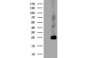 HEK293T cells were transfected with the pCMV6-ENTRY control (Left lane) or pCMV6-ENTRY CLPP (Right lane) cDNA for 48 hrs and lysed. (CLPP Antikörper)