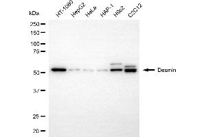 Western blotting analysis using desmin antibody (ABIN7798313).