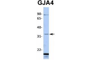 Western Blotting (WB) image for anti-Gap Junction Protein, alpha 4, 37kDa (GJA4) (Middle Region) antibody (ABIN2774856)
