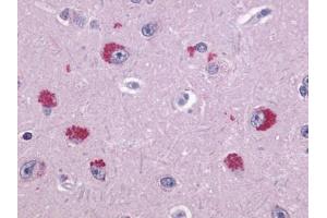 Anti-TAAR1 antibody IHC of human brain, neurons.