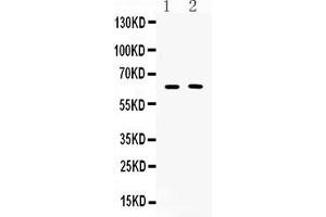 Western blot analysis of TUB 1 expression in COLO320 whole cell lysates ( Lane 1) and MCF-7 whole cell lysates ( Lane 2).