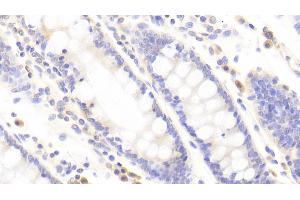 Detection of TJP2 in Human Colon Tissue using Polyclonal Antibody to Tight Junction Protein 2 (TJP2) (TJP2 Antikörper  (AA 307-669))