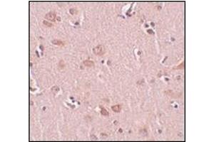 Immunohistochemistry of FAM59A in human liver tissue with this product at 5 μg/ml. (PLEKHM2 Antikörper  (C-Term))