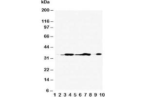 Western blot testing of Annexin V antibody and Lane 1:  rat brain;  2: rat skeletal muscle;  3: rat ovary;  4: rat lung;  5: MCF-7;  6: SMMC-7721;  7: A549;  8: Jurkat;  9: SGC;  10: HT1080;  Predicted molecular weight ~36 kDa. (Annexin V Antikörper  (AA 88-102))