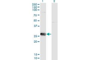 Western Blot analysis of SIRT3 expression in transfected 293T cell line by SIRT3 monoclonal antibody (M09), clone 1A4. (SIRT3 Antikörper  (AA 297-399))