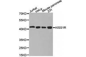 Western Blotting (WB) image for anti-KISS1 Receptor (KISS1R) antibody (ABIN1873420) (KISS1R Antikörper)