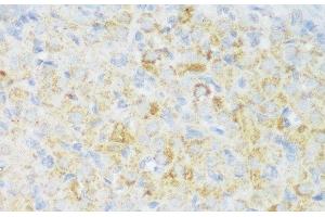 Immunohistochemistry of paraffin-embedded Rat ovary using CACNB3 Polyclonal Antibody at dilution of 1:150 (40x lens). (CACNB3 Antikörper)