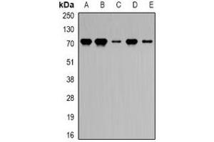 Western blot analysis of PRDM5 expression in HEK293T (A), mouse heart (B), mouse lung (C), rat kidney (D), rat liver (E) whole cell lysates.