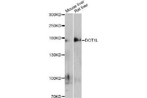 Western blot analysis of extracts of various cell lines, using DOT1L antibody (ABIN5997614) at 1/500 dilution. (DOT1L Antikörper)