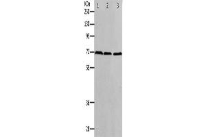 Western Blotting (WB) image for anti-Protein Arginine Methyltransferase 5 (PRMT5) antibody (ABIN2426359) (PRMT5 Antikörper)