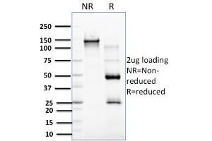 SDS-PAGE Analysis Purified RCAS1 Mouse Monoclonal Antibody (CPTC-EBAG9-2). (RCAS1 Antikörper)