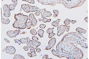 IHC analysis of COMT using anti-COMT antibody (ABIN7601948). (COMT Antikörper  (AA 52-271))