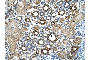 Immunohistochemistry (IHC) image for anti-Suppression of Tumorigenicity 14 (Colon Carcinoma) (ST14) (C-Term) antibody (ABIN2773910)