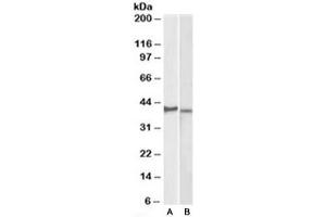 Western blot testing of KELLY [A] and U251-MG [B] lysates with CX3CR1 antibody at 2ug/ml. (CX3CR1 Antikörper)