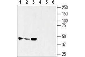 Western blot analysis of rat spleen (lanes 1 and 4), mouse spleen (lanes 2 and 5) and mouse brain (lanes 3 and 6) lysates: - 1-3. (Septin 7 Antikörper  (Intracellular))