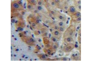IHC-P analysis of Liver tissue, with DAB staining. (GDF5 Antikörper  (AA 382-501))