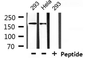 Western Blotting (WB) image for anti-Collagen, Type IV, alpha 1 (COL4A1) antibody (ABIN6260943)