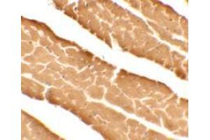 Immunohistochemistry of DDA1 in mouse heart tissue with DDA1 antibody at 5 ug/mL. (DDA (C-Term) Antikörper)