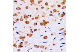 Immunohistochemical analysis of AKT staining in human brain formalin fixed paraffin embedded tissue section.