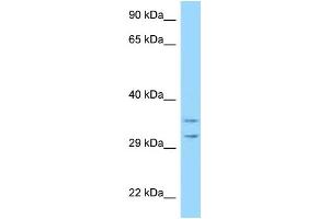 WB Suggested Anti-RPS2 Antibody Titration: 1. (RPS2 Antikörper  (Middle Region))