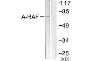 Western blot analysis of extracts from HeLa cells, treated with PMA 125ng/ml 30', using A-RAF (Ab-301/302) Antibody. (ARAF Antikörper  (AA 276-325))
