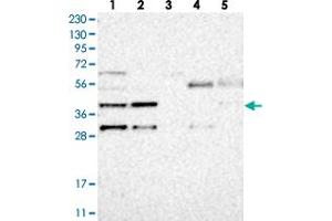 Western blot analysis of Lane 1: RT-4, Lane 2: U-251 MG, Lane 3: Human Plasma, Lane 4: Liver, Lane 5: Tonsil with MB21D1 polyclonal antibody .