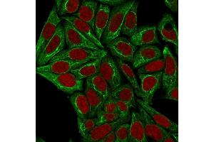 Immunofluorescence staining of HeLa cells using Pan-Cytokeratin Mouse Monoclonal Antibody (PCK/3150) followed by goat anti-Mouse IgG conjugated to CF488 (green). (KRT Antikörper)