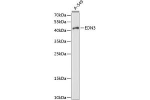 Western blot analysis of extracts of A-549 cells, using EDN3 antibody (ABIN6127870, ABIN6139934, ABIN6139936 and ABIN6214707) at 1:1000 dilution. (Endothelin 3 Antikörper  (AA 17-187))