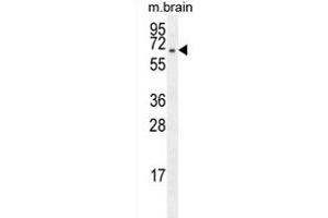 FBXO21 Antibody (C-term) (ABIN655273 and ABIN2844865) western blot analysis in mouse brain tissue lysates (35 μg/lane). (FBXO21 Antikörper  (C-Term))