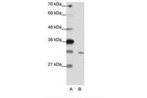 Image no. 2 for anti-Zinc Finger Protein 397 (ZNF397) (C-Term) antibody (ABIN202144) (ZNF397 Antikörper  (C-Term))