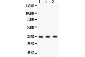 Western blot analysis of Cathepsin G expression in COLO320 whole cell lysates ( Lane 1), MCF-7 whole cell lysates ( Lane 2) and U20S whole cell lysates ( Lane 3). (Cathepsin G Antikörper  (AA 25-252))