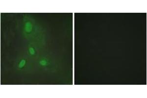 Immunofluorescence analysis of HeLa cells, using BACH1 Antibody. (BACH1 Antikörper  (AA 131-180))
