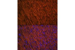Immunohistochemistry of paraffin-embedded human colon using Desmin Rabbit mAb (ABIN1678733, ABIN3018020, ABIN3018021 and ABIN7101569) at dilution of 1:100 (40x lens). (Desmin Antikörper)