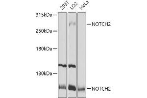 Western blot analysis of extracts of various cell lines, using NOTCH2 antibody (ABIN6132419, ABIN6144736, ABIN6144737 and ABIN6213887) at 1:1000 dilution. (NOTCH2 Antikörper  (AA 2242-2471))
