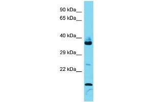 Host: Rabbit  Target Name: Fam133b  Sample Tissue: Mouse Thymus lysates  Antibody Dilution: 1. (FAM133B Antikörper  (Middle Region))