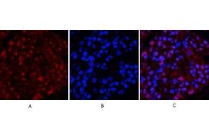 Immunofluorescence analysis of rat kidney tissue. (TUBB Antikörper  (AA 370-450))