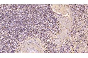 Detection of CD63 in Human Spleen Tissue using Monoclonal Antibody to Tetraspanin 30Cluster of Differentiation 63 (CD63) (CD63 Antikörper  (AA 103-203))