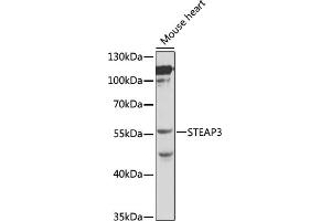 Western blot analysis of extracts of mouse heart, using STE antibody (ABIN3021067, ABIN3021068, ABIN3021069 and ABIN6213936) at 1:1000 dilution. (STEAP3 Antikörper  (AA 1-180))