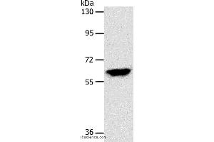 Western blot analysis of Mouse brain tissue, using INA Polyclonal Antibody at dilution of 1:500 (INA Antikörper)