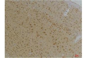 Immunohistochemistry (IHC) analysis of paraffin-embedded Mouse Brain Tissue using Kv1.