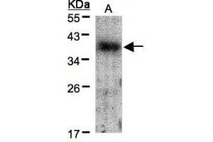 Image no. 2 for anti-V-Crk Sarcoma Virus CT10 Oncogene Homolog (Avian) (CRK) (AA 122-302) antibody (ABIN467422) (Crk Antikörper  (AA 122-302))