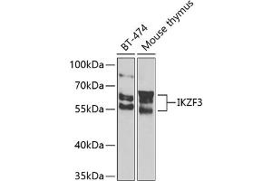 Western blot analysis of extracts of various cell lines, using IKZF3 Antibody (ABIN6130489, ABIN6142290, ABIN6142291 and ABIN6223116) at 1:1000 dilution. (IKZF3 Antikörper  (AA 280-450))