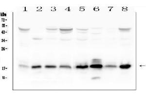 Western blot analysis of TIMM17A using anti-TIMM17A antibody (ABIN6719637). (TIMM17A Antikörper)