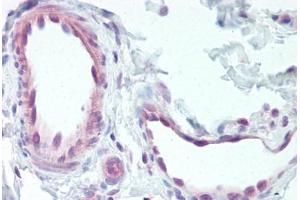 Immunohistochemistry (IHC) image for anti-Endothelin Receptor Type B (EDNRB) (C-Term) antibody (ABIN1048560)