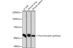 Western blot analysis of extracts of various cell lines, using Thromboxane synthase Rabbit mAb (ABIN7270821) at 1:1000 dilution. (TBXAS1 Antikörper)