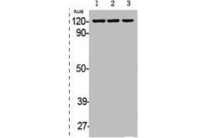 Western Blot analysis of HELA A431 cells using Phospho-EphB1/2 (Y594/604) Polyclonal Antibody (EPH Receptor B1 Antikörper  (pTyr594, pTyr604))