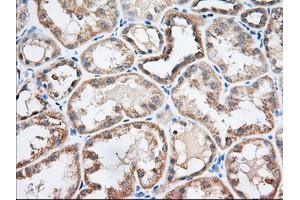 Immunohistochemical staining of paraffin-embedded Human liver tissue using anti-EIF2S1 mouse monoclonal antibody. (EIF2S1 Antikörper)