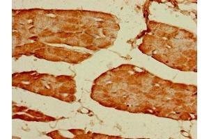 Immunohistochemistry of paraffin-embedded human skeletal muscle tissue using ABIN7153992 at dilution of 1:100 (GRIN2C Antikörper  (AA 908-1007))