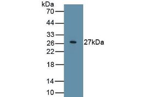 Detection of Recombinant WIF1, Human using Polyclonal Antibody to WNT Inhibitory Factor 1 (WIF1) (WIF1 Antikörper  (AA 29-379))
